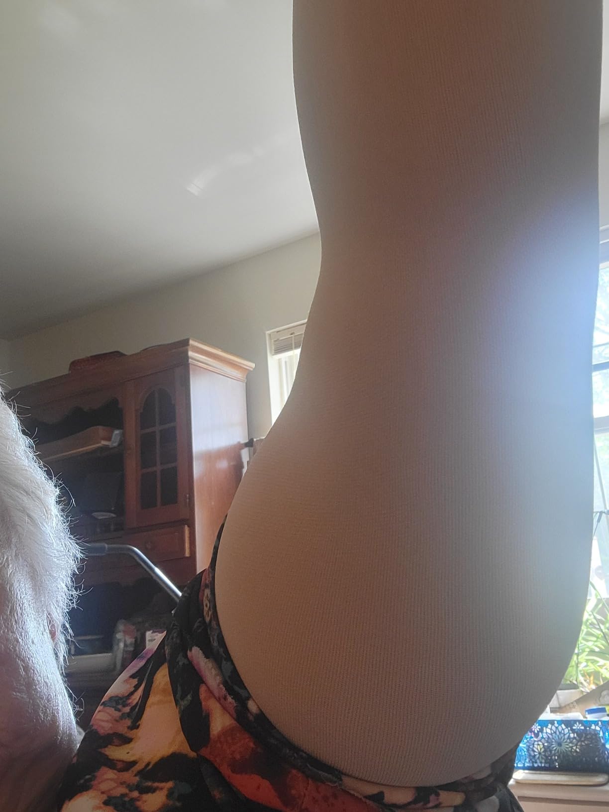 KEKING® Lymphedema Compression Arm Sleeves for Men Women (Pair), No Silicone Dot, 15-20 mmHg Compression Full Arm Support for Lipedema, Edema, Post Surgery Recovery, Swelling, Pain Relief, Beige XL customer photo 1