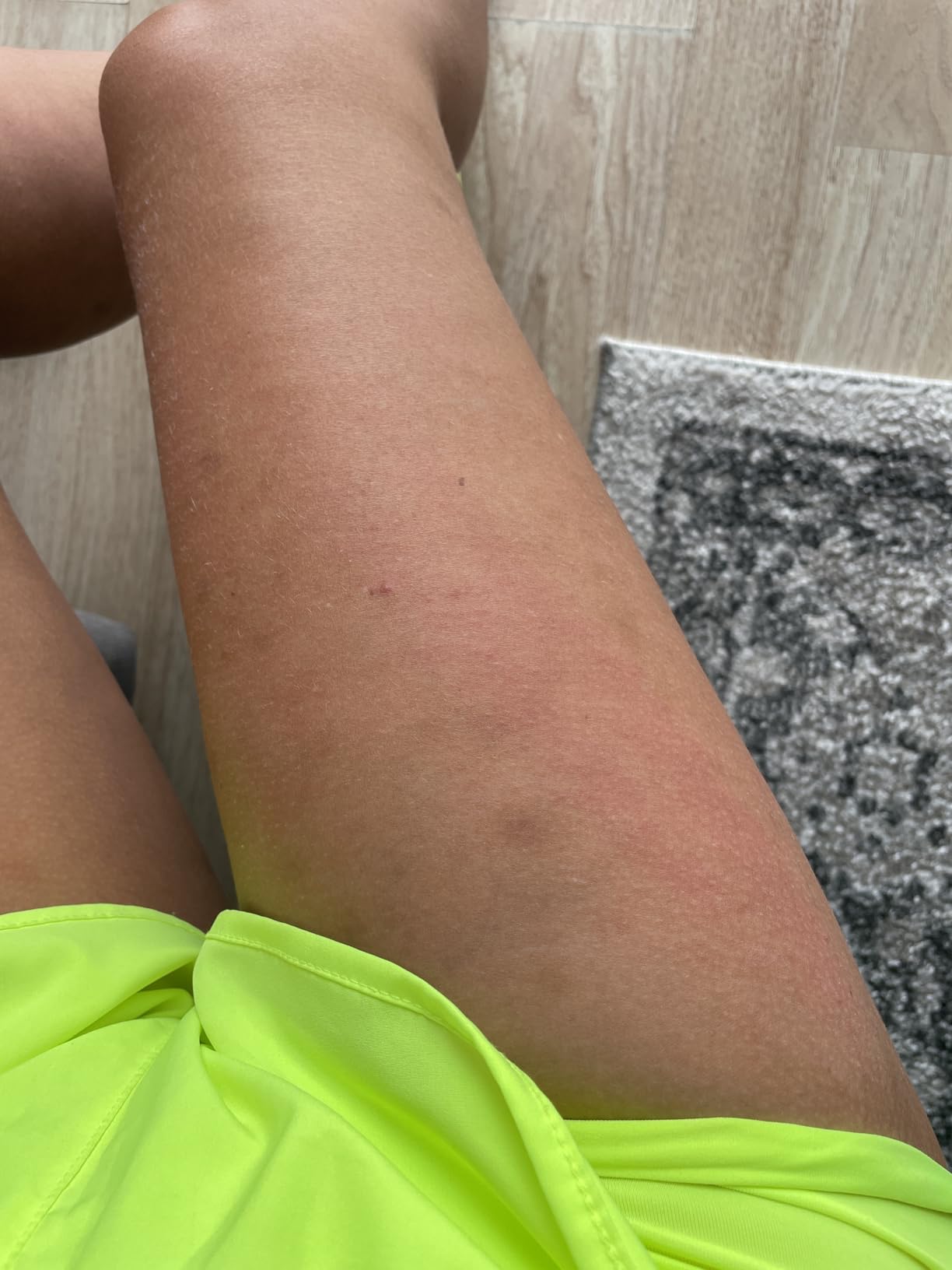 TESMED Cellulite Manual Massager : Made in Italy, Patented with Converging & Diverging Roller Technology. Anti Cellulite Roller for Thighs and Buttock customer photo 2