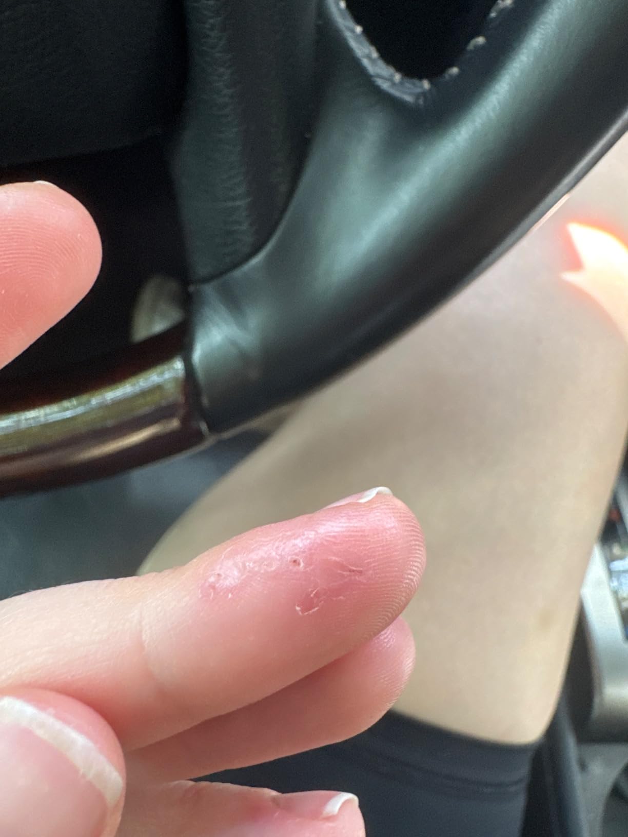 Cetaphil Cracked Skin Repair Balm, 3 oz, For Very Rough & Cracked, Sensitive Skin, Protects, Soothes & Restores Deeper Cracks customer photo 2
