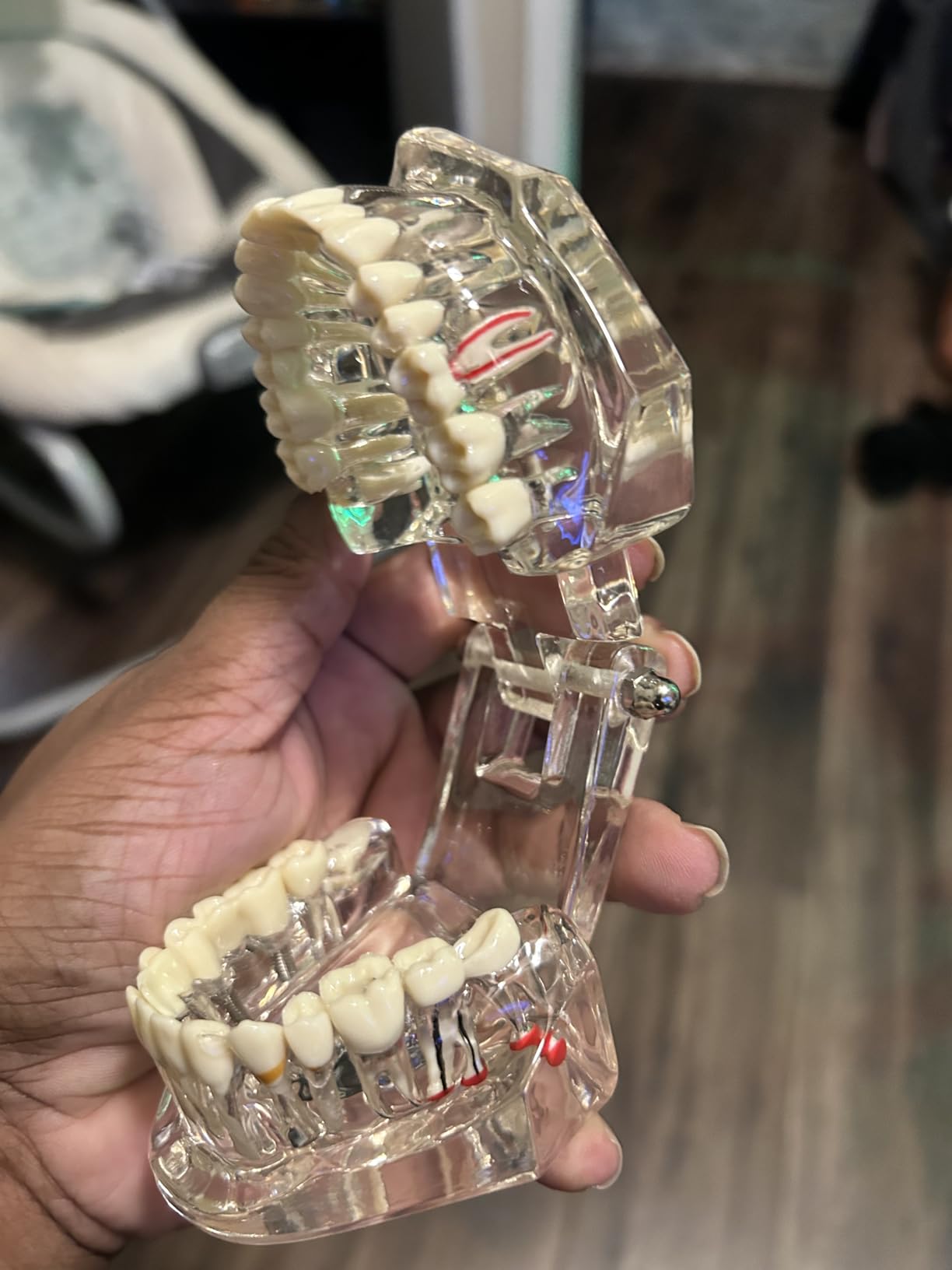 Ultrassist Transparent Disease Teeth Model with Dental Implant Bridge, Dental Model for Patient and Dental Student Education customer photo 1