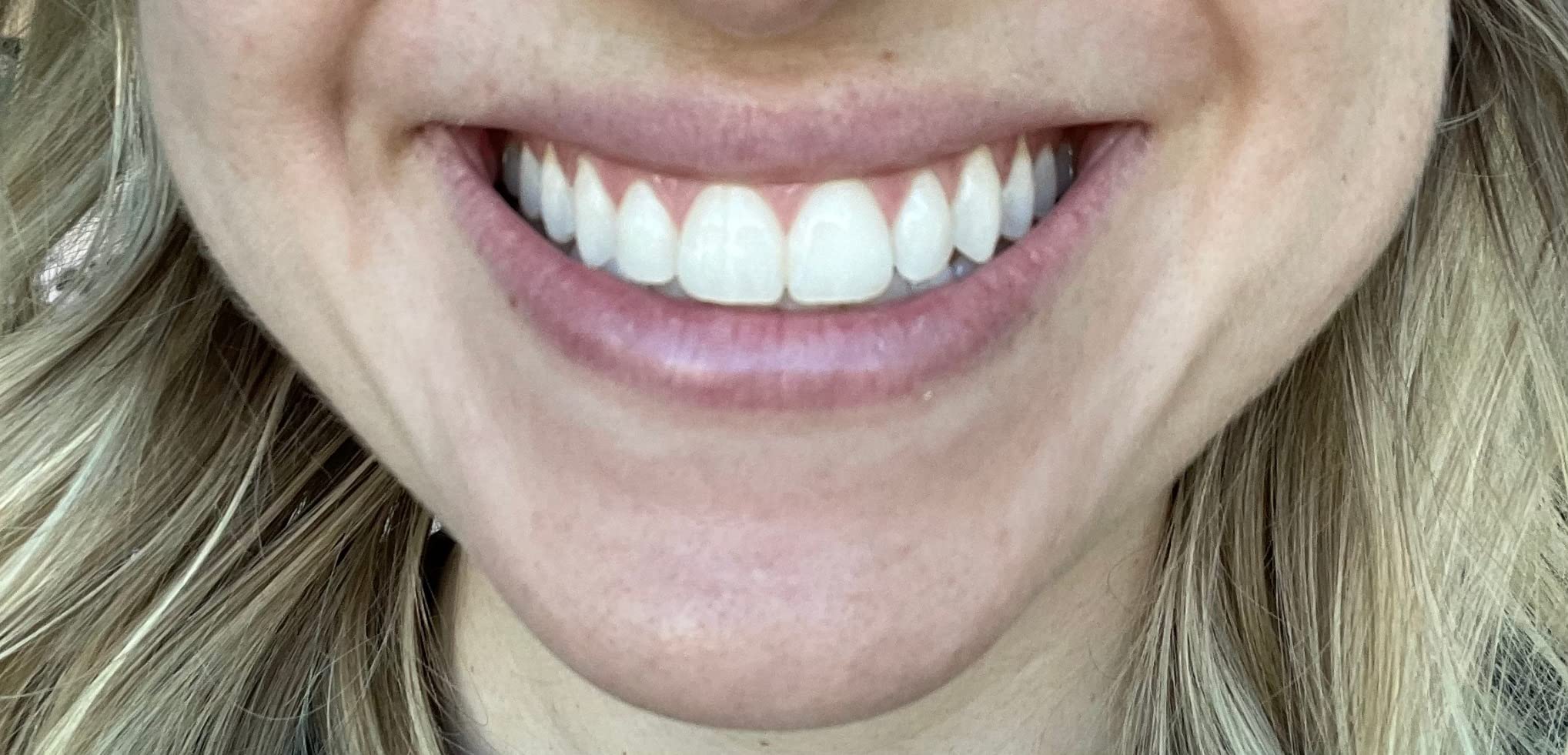 MOON Teeth Whitening Pen, Platinum Mint, 0.09 Fl Oz, Gentle on Teeth, Whitens with Antioxidants & Essential Oils, Vegan Whitening Gel in an Easy Applicator customer photo 1