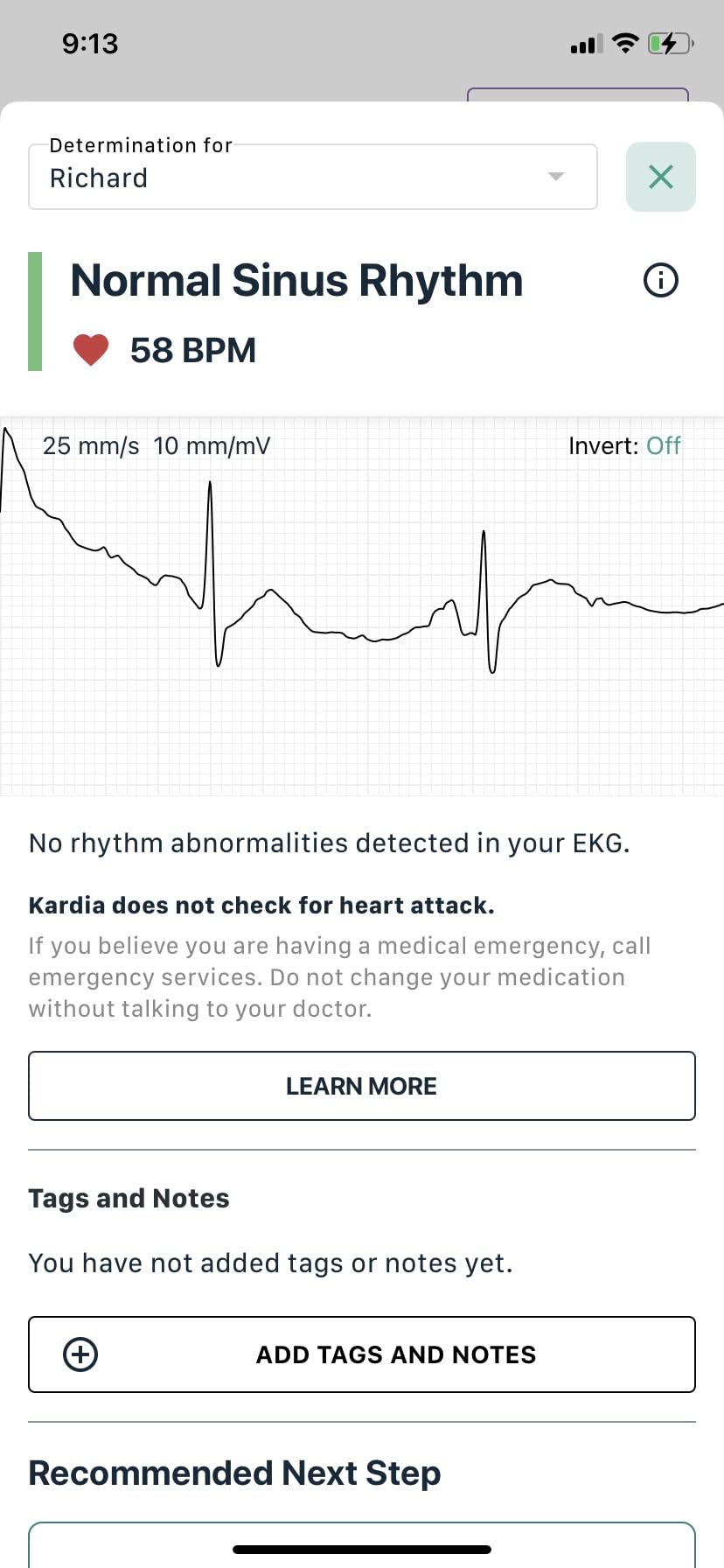 KardiaMobile Card Credit-Card Sized EKG, Medical-Grade & FDA-Cleared Personal Heart Monitor, Carry in Wallet, Bluetooth-Enabled for On-The-Go Check-Ups Anywhere, Compatible with Most Smartphones customer photo 2