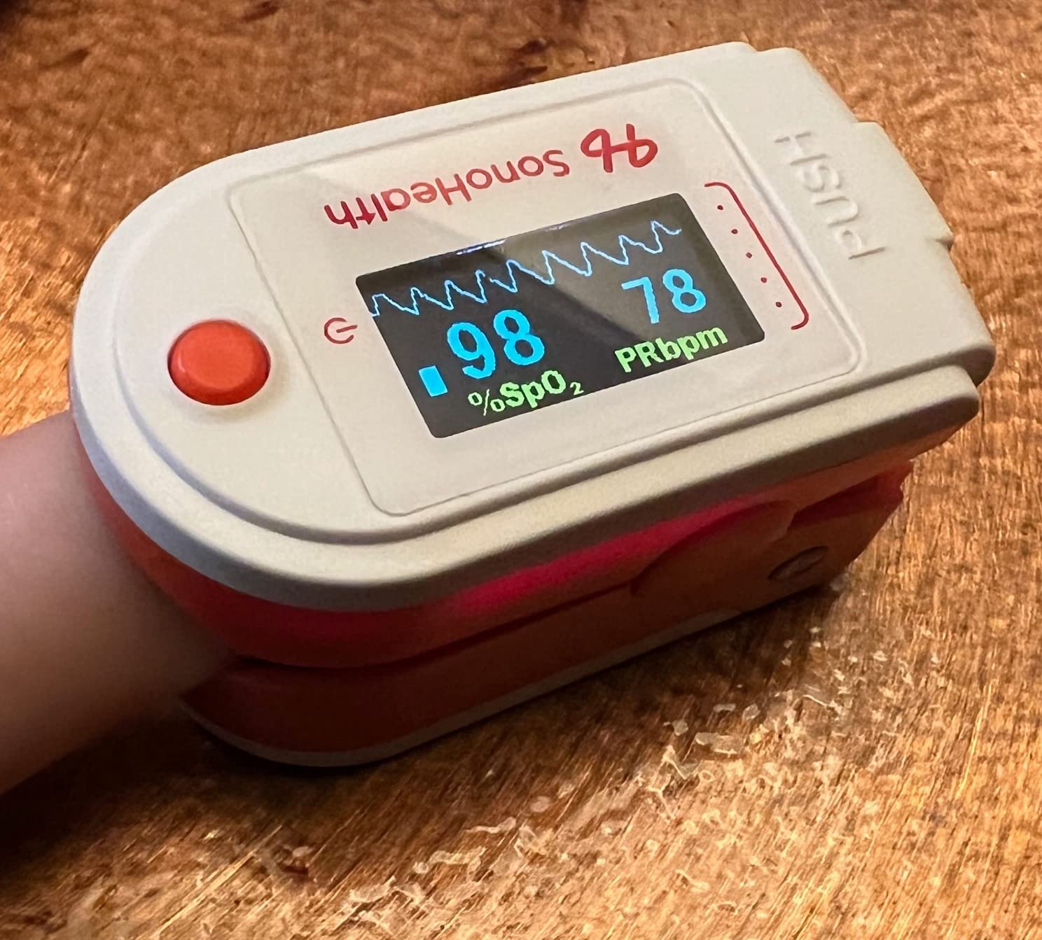 Pulse Oximeter by SonoHealth - Fingertip Blood Oxygen Saturation Monitor, Data Recording, Bluetooth-Enabled - Lifetime Mobile App Access (Pulse Oxi V 1.0) customer photo 1