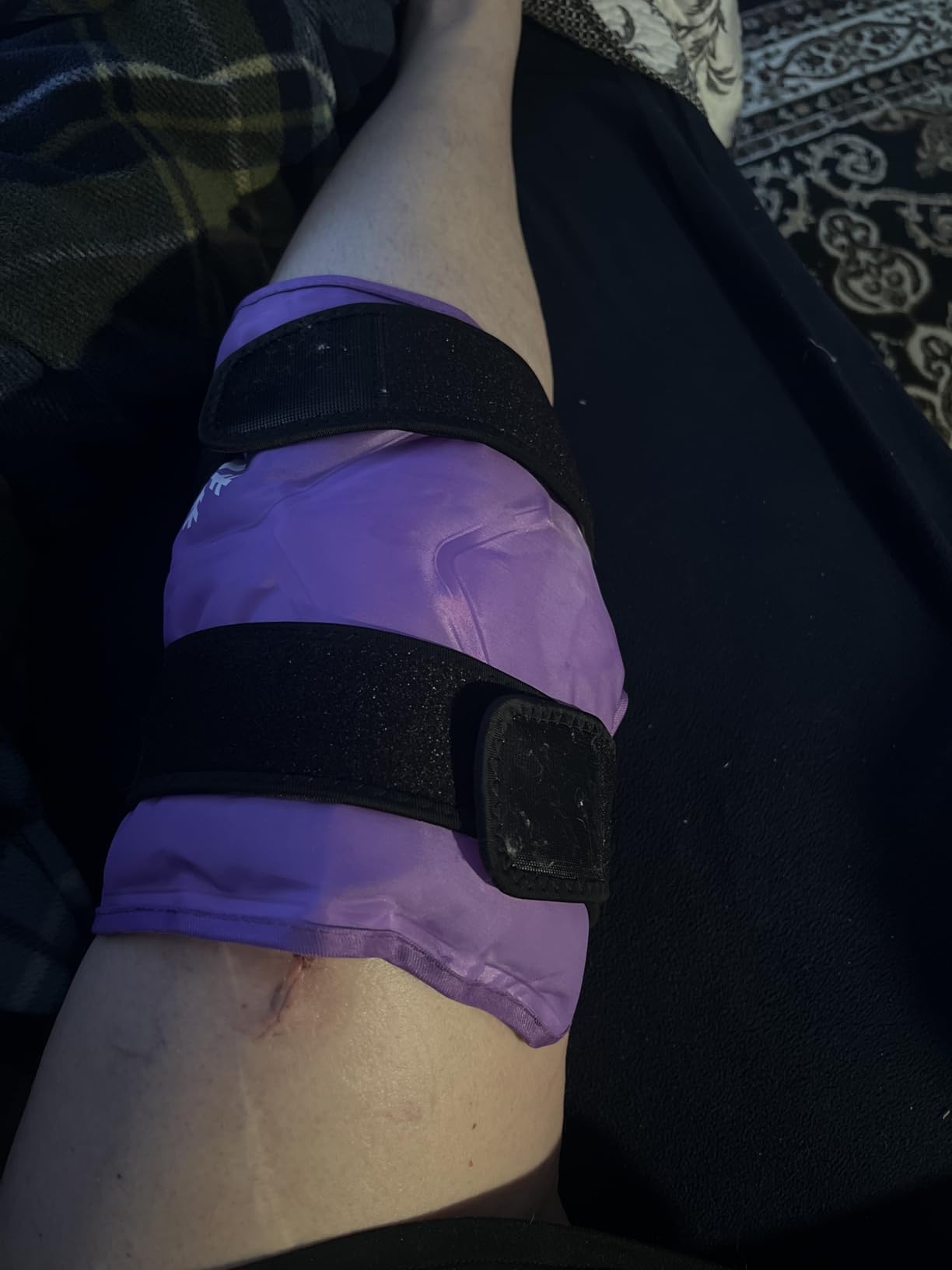 KingPavonini XXL Knee Ice Pack Wrap Around Entire Knee After Surgery, Large Reusable Gel Ice Pack for Injuries, Pain Relief, Swelling, Sports Injuries, 1 Pack (Blue) customer photo 2