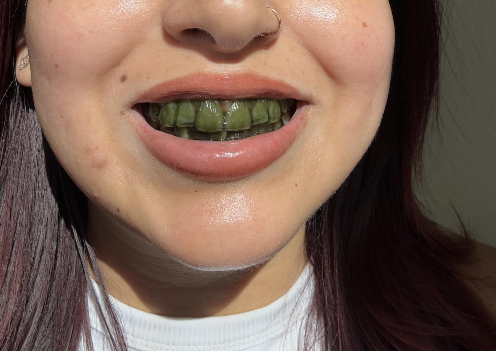 InoPro Teeth Whitening Strips 14 Treatments Kit - Peroxide-Free with Arbutin, Coconut Oil customer photo 2