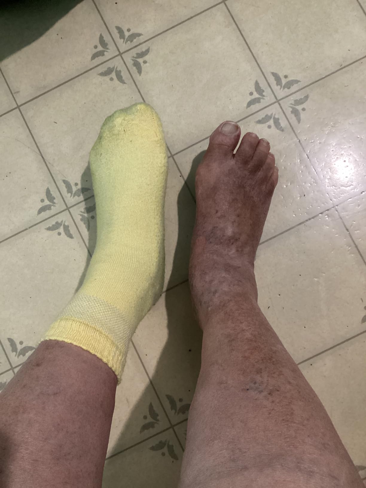 Pembrook Bamboo Viscose Diabetic Socks for Women & Men - 6 Pairs Ankle Socks for Swollen Feet | Neuropathy Socks customer photo 1