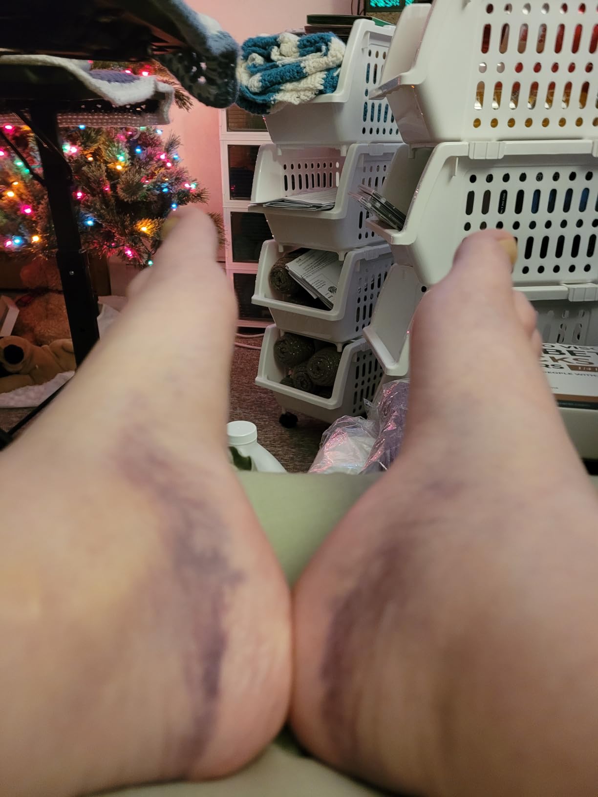 Pembrook Bamboo Viscose Diabetic Socks for Women & Men - 6 Pairs Ankle Socks for Swollen Feet | Neuropathy Socks customer photo 2