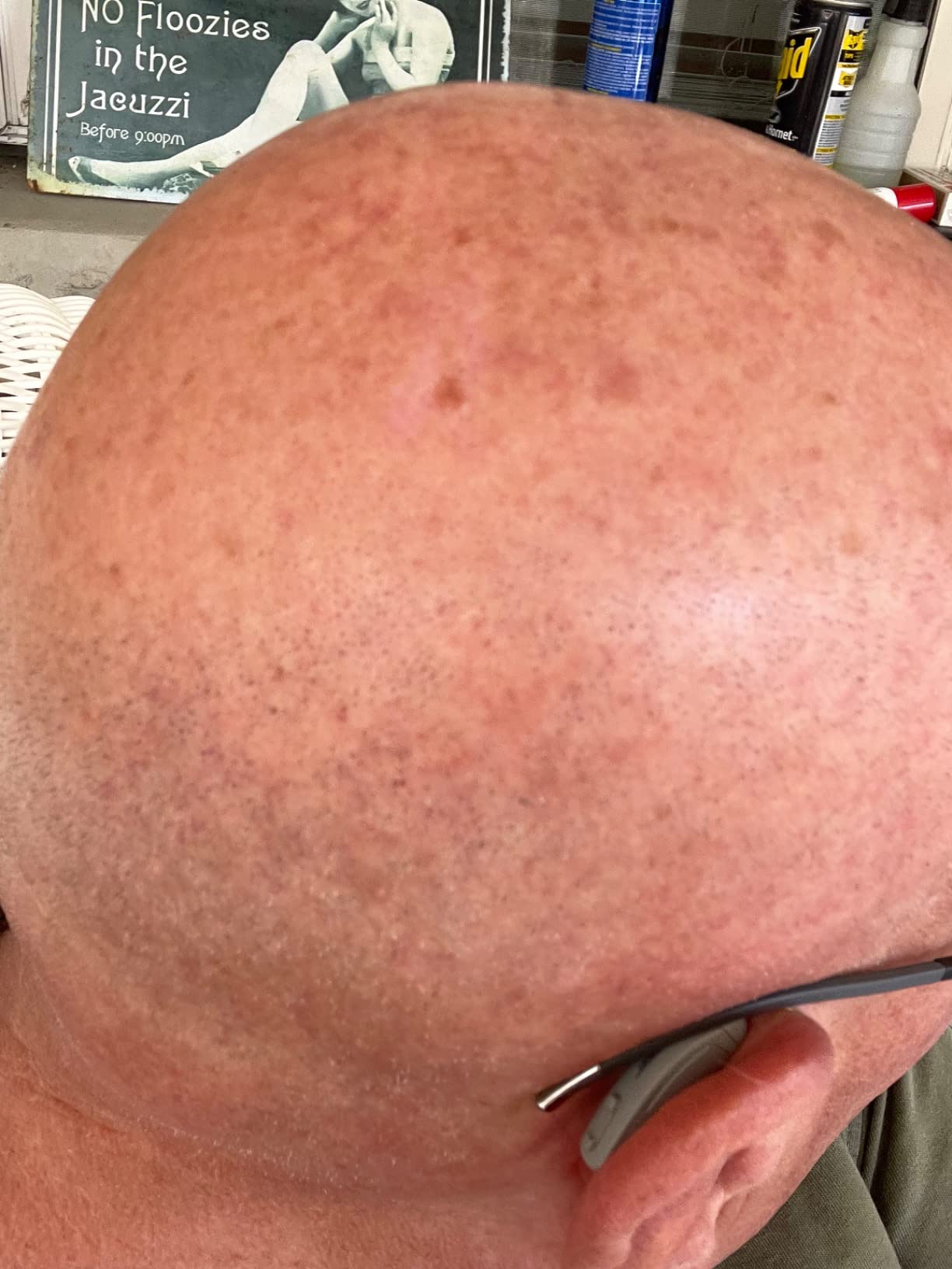 Lexie B1 OTC Hearing Aids Powered by Bose - Bluetooth Enabled Hearing Aids with Invisible Fit and All Day Comfort, App Control, Noise Reduction and Self-Fit Solution, Replaceable Batteries, Gray customer photo 1