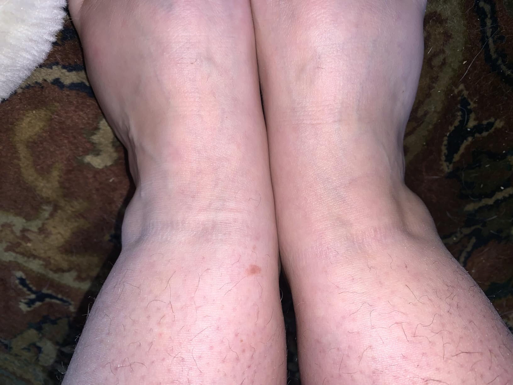 Doctor's Select Diabetic Socks for Men - 4 Pairs Crew Diabetic Neuropathy Socks for Men | Diabetic Socks for Men 9-12 customer photo 2