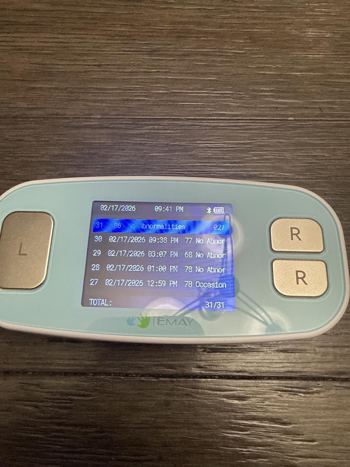 EMAY 6L Portable ECG Monitor | Record ECG and Heart Rate in 6 Channels | Compatible with Smartphone and PC | No Subscription Required customer photo 2