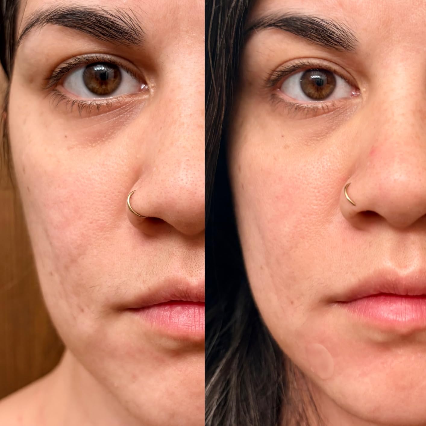 LifePro Red Light Therapy for Body Panel - 90 & 120 Dual Chip LEDs - 660nm & 850nm Near Infrared Full Body Red light Therapy Panel - For Daily Wellness & Comfort -Includes Hanging Kit and Eyewear customer photo 1