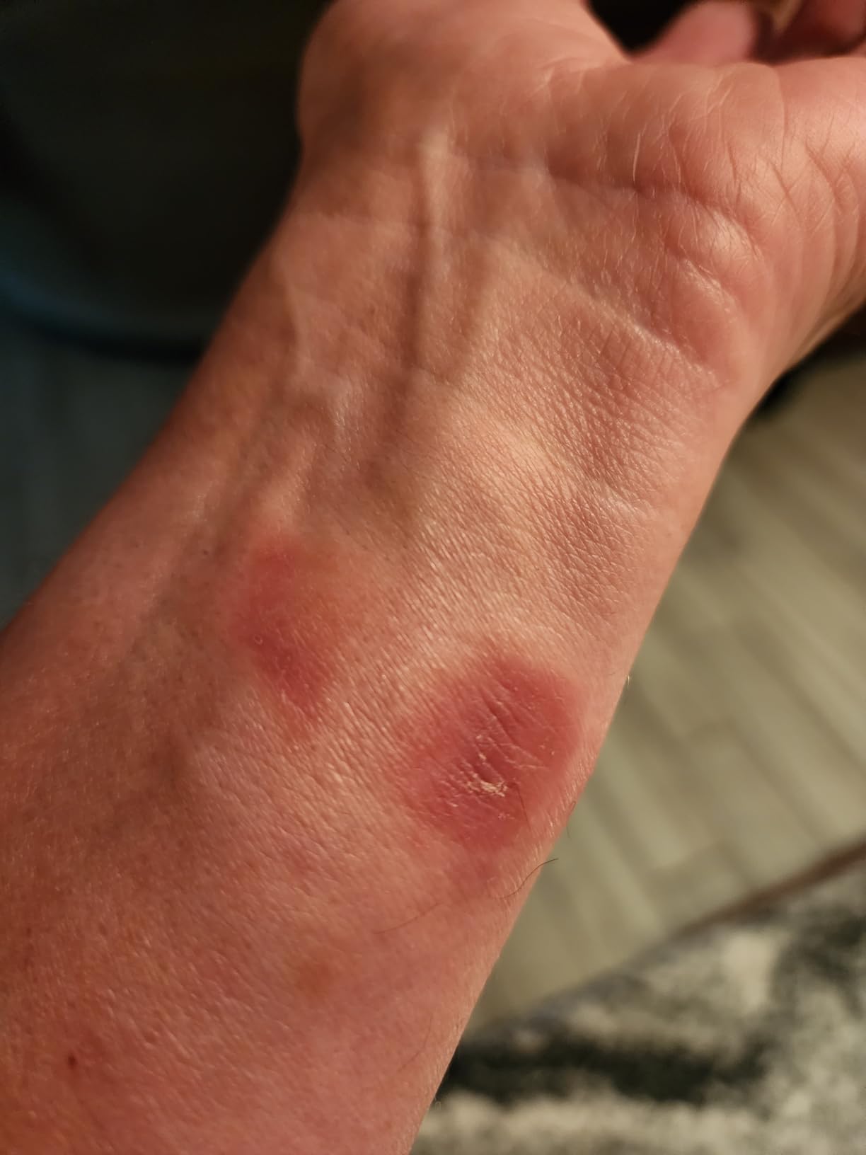 Charge 6 Activity Tracker Heart Rate Monitoring, 7-Day Battery, Integrated Google Apps, Maps & Wallet, in-Depth Health Insights, Activity & Sleep Analysis, (Obsidian/Black) customer photo 1