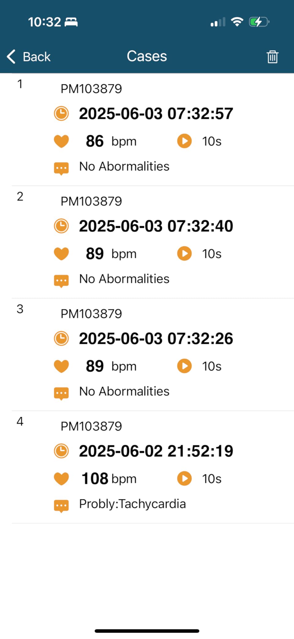 EKG Monitor Device, Personal Heart Rate Monitor with LCD Screen and Storage, Portable ECG Monitor Compatible with PC and Smartphone, Instant Results in 30 Seconds customer photo 1