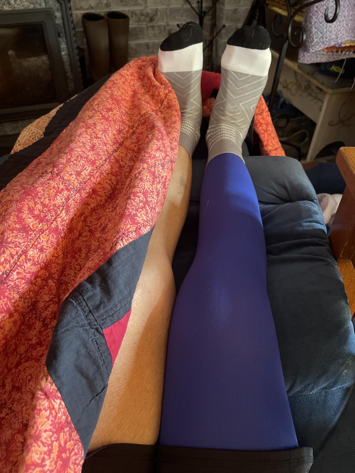 Doc Miller Thigh High Open Toe Compression Stockings 15-20mmHg for Varicose Veins, Pregnancy Support customer photo 1