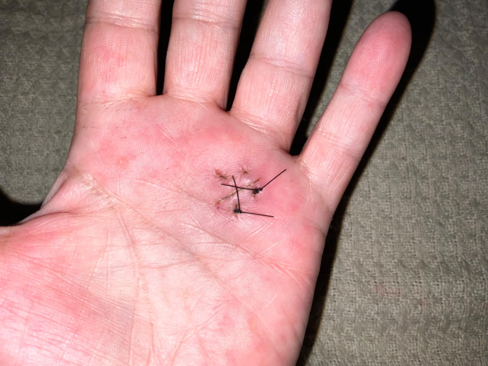 Niveus PowerStrips - Dentist Developed Latex-Free Therapeutic Tape with Strong Adhesion and Breathable Cotton - Gentle Skin Tape for Comfort & Support - for Men and Women (Tan, 60 Strips) customer photo 1