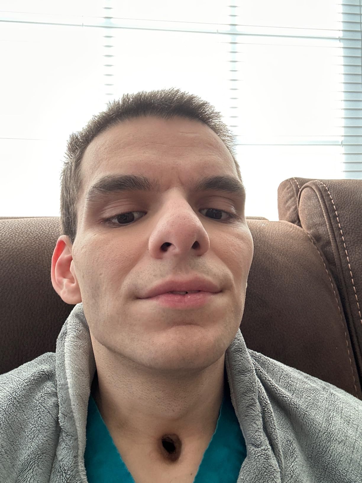 Braun Smart IPL, Skin i·Expert Pro 7, VOGUE's Best Hair Removal Device, IPL Hair Removal for Women and Men, Permanent Laser Hair Reduction At-Home, World's 1st Smart App, 3 Heads, IPL7243 customer photo 1