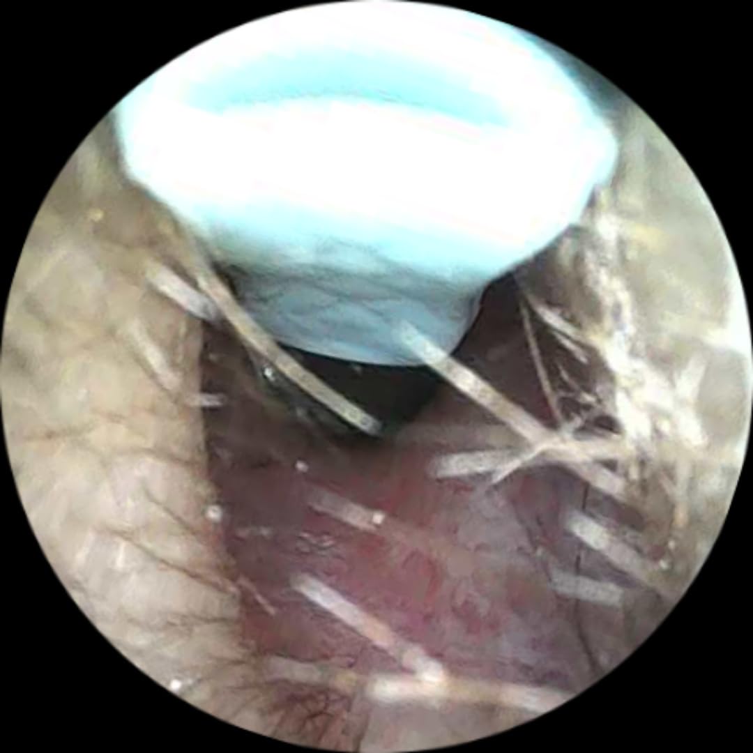 Ear Wax Removal, 3 in 1 Earwax Removal Kit, 1080P HD Ear Cleaner with Camera, FSA HSA Eligible, Otoscope with 7 Ear Spoon, Ear Cleaning 6 LED Lights 15 Ear Tips, Ear Camera for iOS & Android customer photo 2