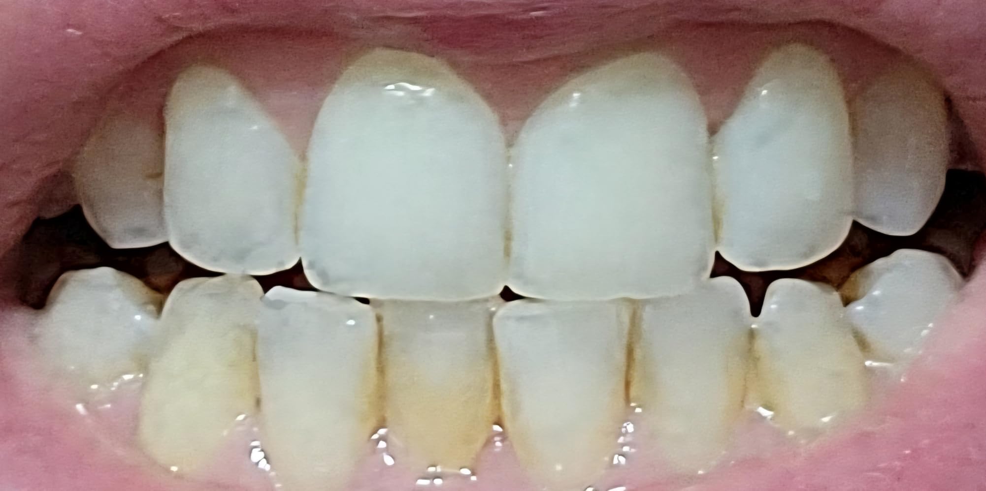 GuruNanda Hydroxyapatite Toothpaste, SLS & Fluoride Free, Whitening Toothpaste with Tongue Scraper & Squeezer - Freshens Breath, Fights Plaque - Natural CocoMint Jasmine Neem, 4.2oz customer photo 1