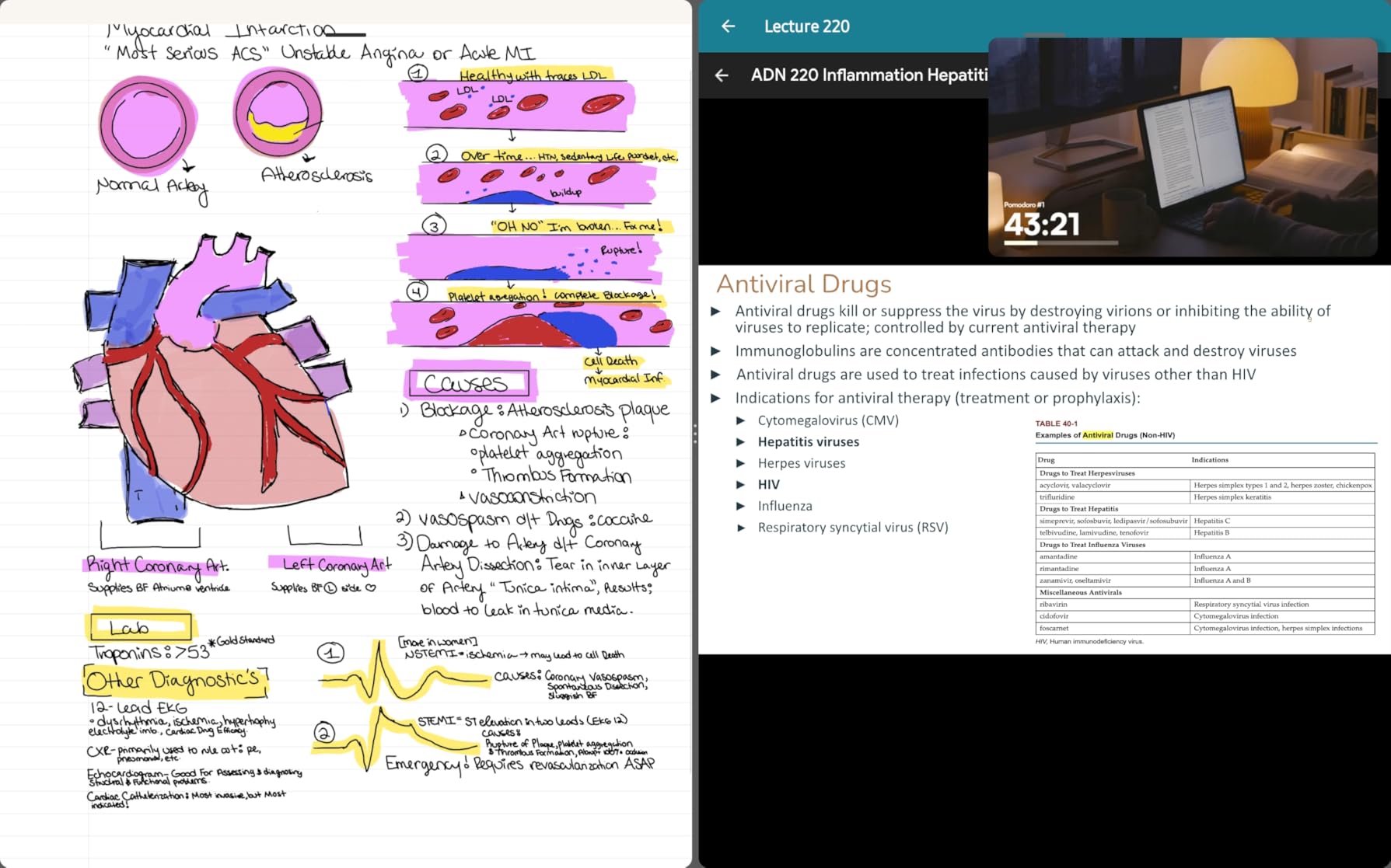 reMarkable Paper Pro Bundle - 11.8-inch with Marker Plus Pen customer photo 1