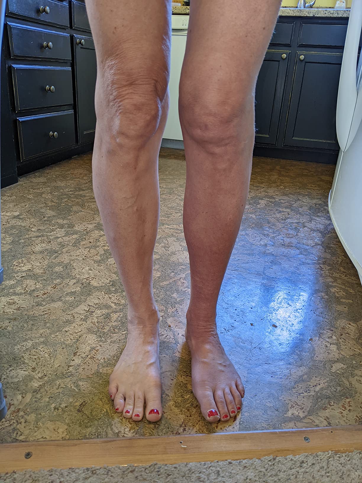 Therabody JetBoots Prime - Ultra-Portable, Wireless Compression Boots for Easy Leg Muscle Recovery - Calf, Leg & Thigh Compression Sleeve with Customizable Treatments (Regular) customer photo 1