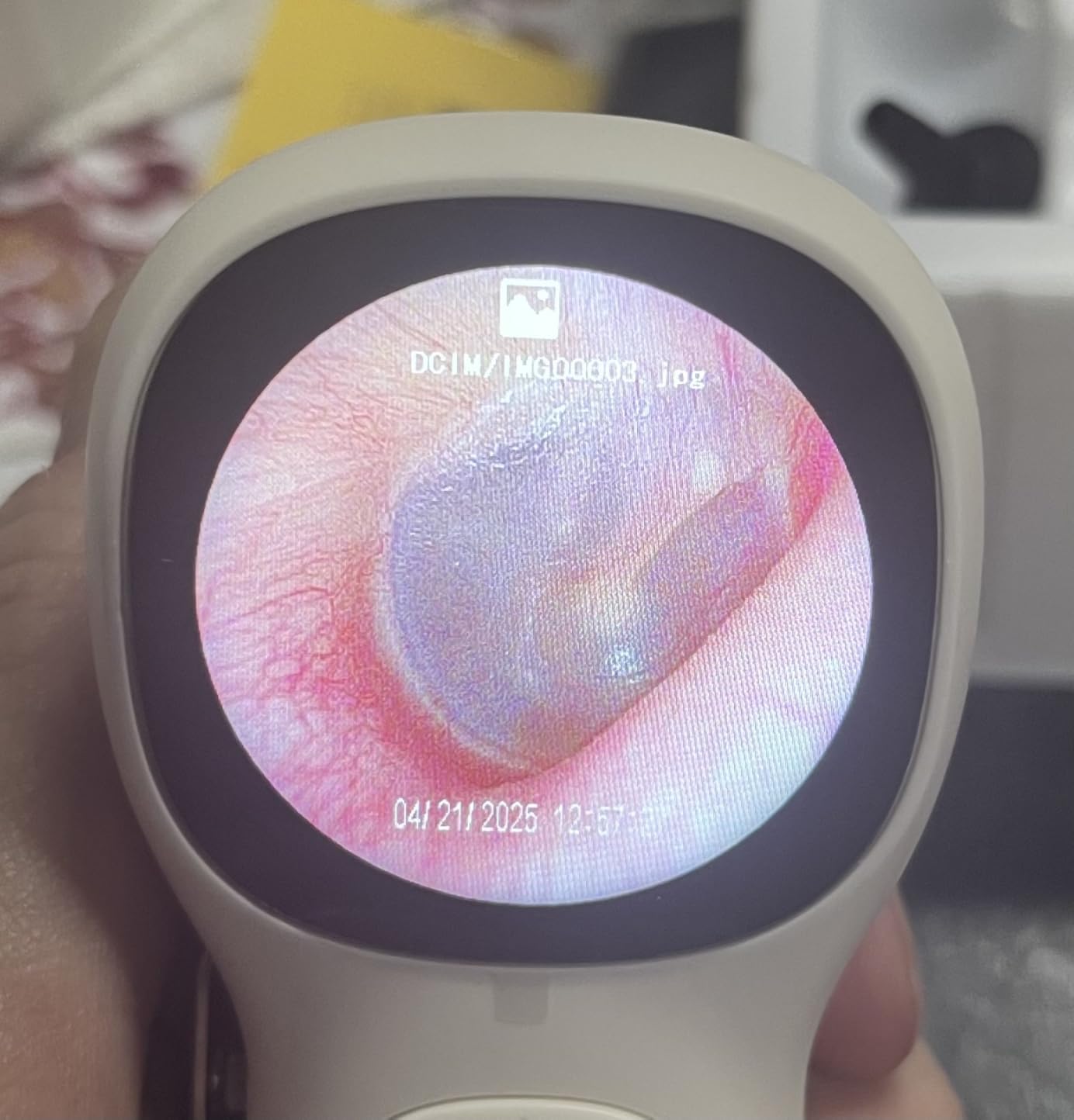 ScopeAround Digital Otoscope w/Built-in Screen, Manual-Focus Digital Otoscope with Light for Home Use, No App Needed, Easy Viewing for Everyday Ear Checks, Otoscope Camera, White customer photo 1