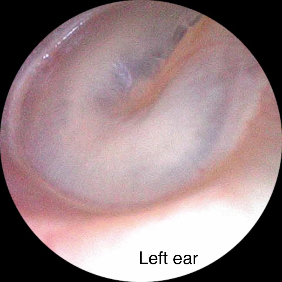 Digital Otoscope Compatible with iPhone and Android Devices, HD Ear Camera with Ear Wax Removal Tools, Video Ear Scope Otoscope with Light, Capture Photos and Videos (Silver) customer photo 1