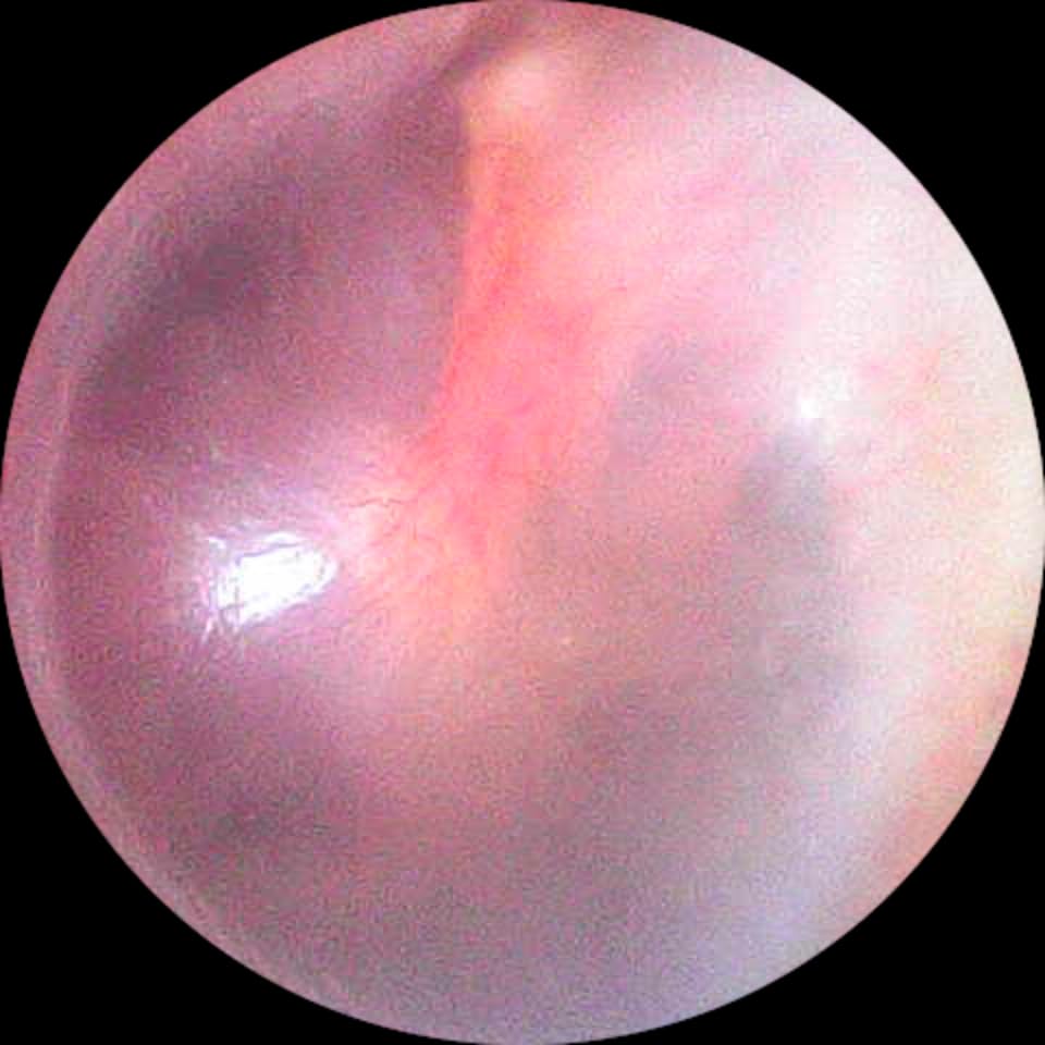 Digital Otoscope Compatible with iPhone and Android Devices, HD Ear Camera with Ear Wax Removal Tools, Video Ear Scope Otoscope with Light, Capture Photos and Videos (Silver) customer photo 2