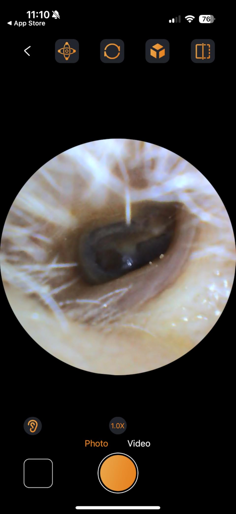 Digital Otoscope with Gyroscope, HD Ear Camera with Ear Wax Removal Tools, Video Ear Scope Otoscope with Light, Compatible with iPhone and Android (Silver) customer photo 1