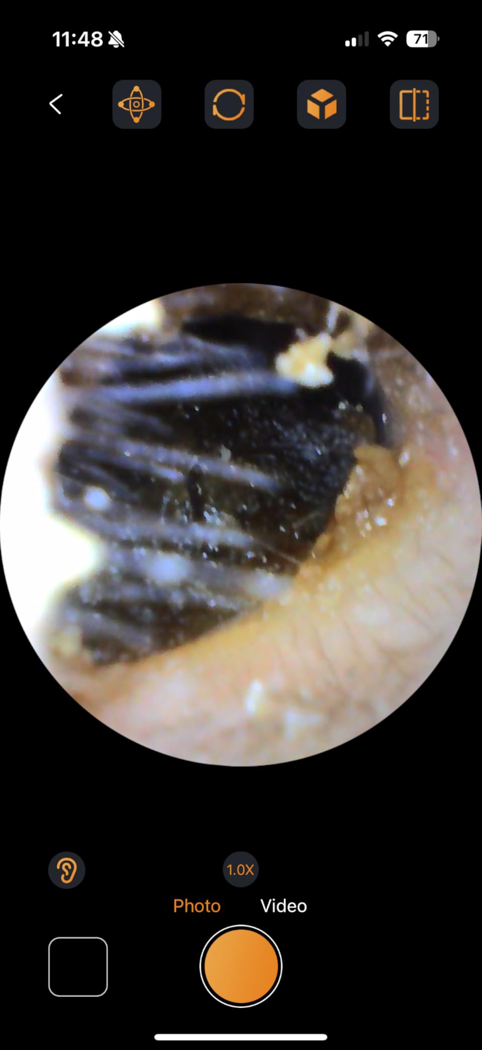 Digital Otoscope with Gyroscope, HD Ear Camera with Ear Wax Removal Tools, Video Ear Scope Otoscope with Light, Compatible with iPhone and Android (Silver) customer photo 2