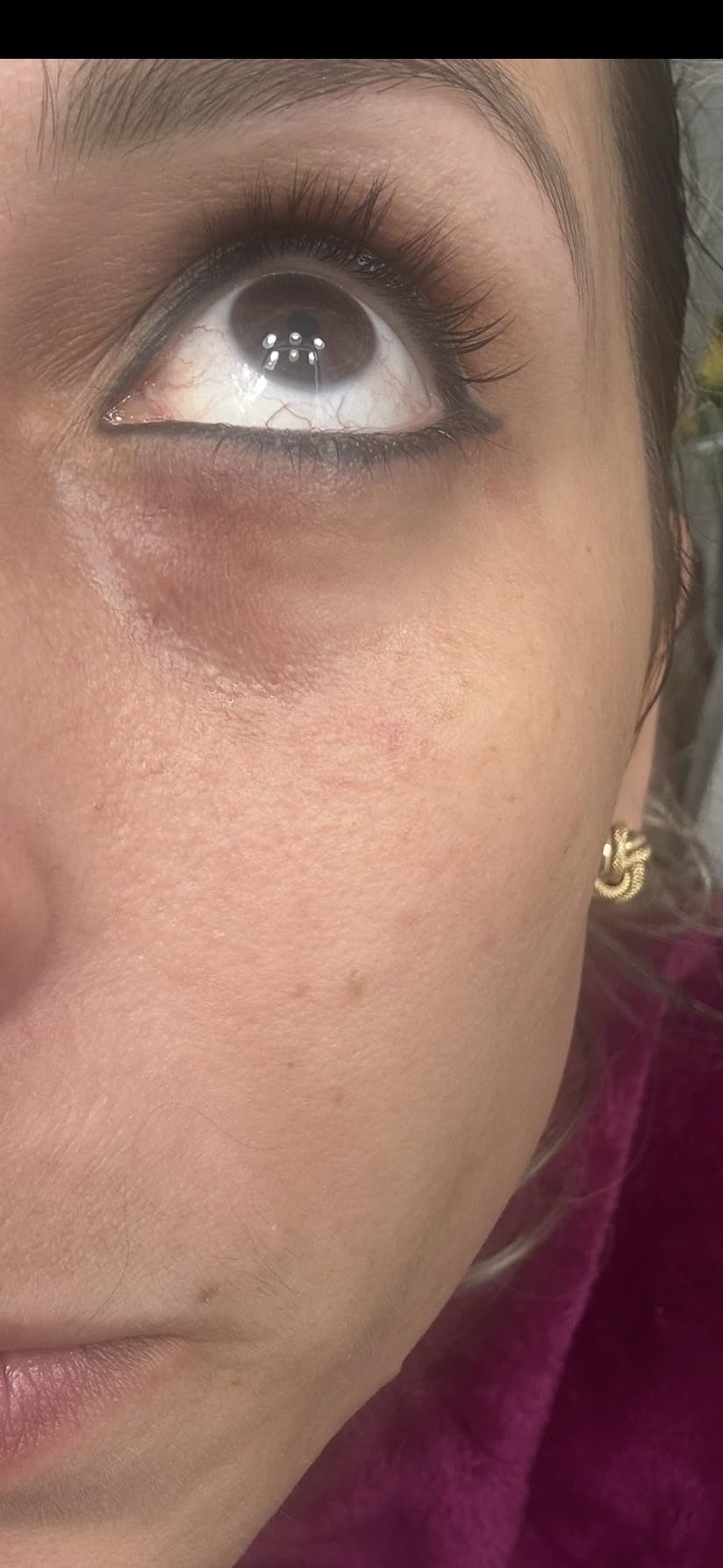 INIA 4-in-1 Eye Massager Tool Under Eye Red Light Therapy for Face, Eye Lift Depuffing Wand with Heat & Vibration for Dark Circles, Puffiness & Skin Firming customer photo 1