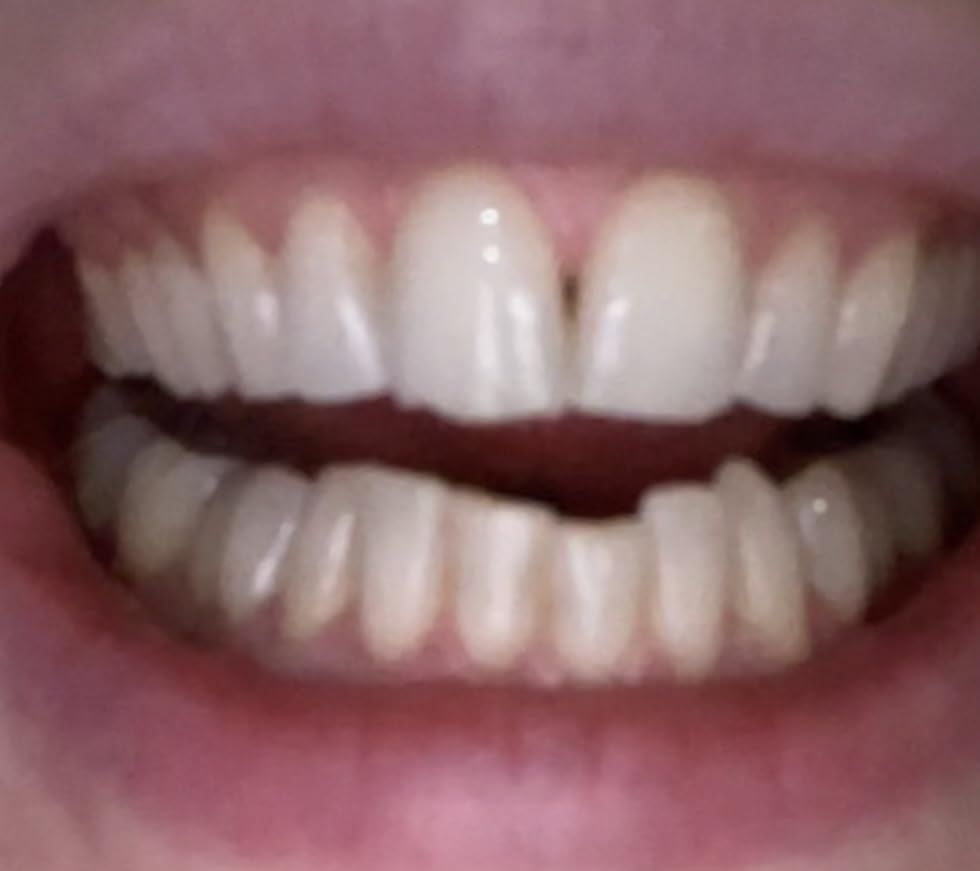 RiseWell Mineral Toothpaste - All Natural Toothpaste with Hydroxyapatite - Made in The USA, No Added Fluoride, Natural SLS-Free Toothpastes - for a Stronger and Healthier Teeth, Wild Mint, 3.4 Oz customer photo 1