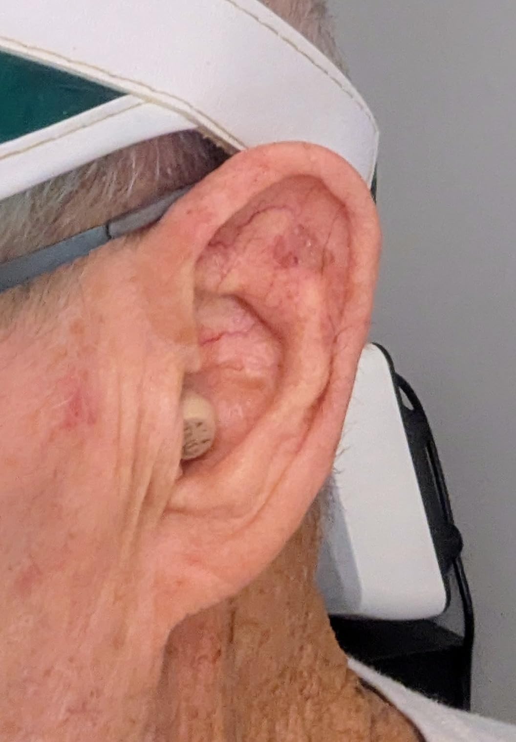 Audien Atom One OTC Hearing Aids - Wireless, Rechargeable, and Comfortable | Clear Sound in a Small, Discreet Design for Seniors & Adults with Hearing Loss customer photo 2