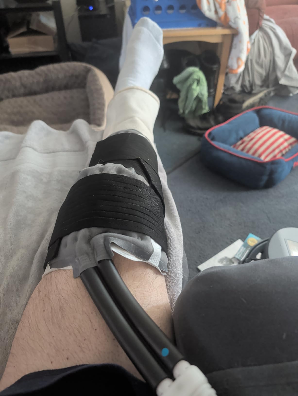 Cold Therapy Machine with Programmable Timer, Ice-Machine-for-Knee-After-Surgery, Knee Replacement Recovery Equipment, Cryotherapy Pain Relief w/Compression Pad for Shoulder, Ankle (Dark Grey) customer photo 1