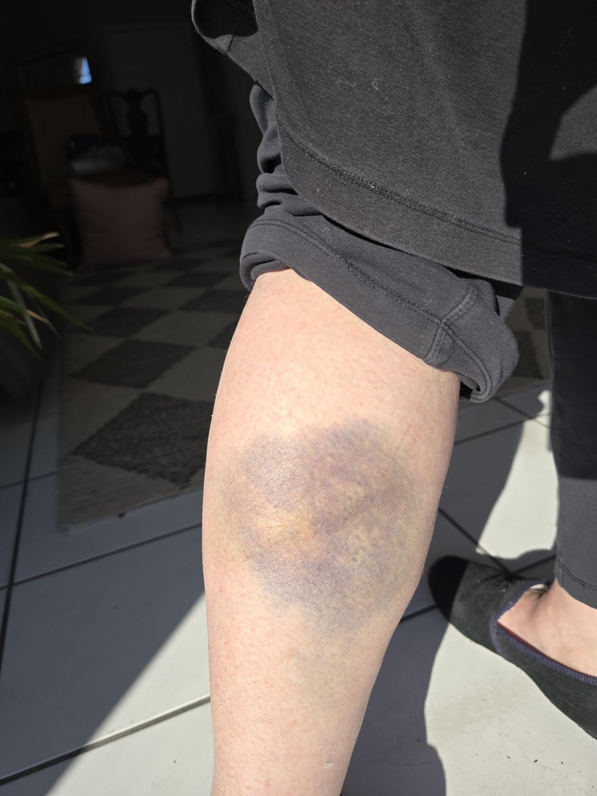 40 Miles Foldable Mobility Scooter for Seniors Paiseec S3 Pro, Lightweight Mobility Scooters, All-Terrain Folding Mobility Scooters, 250W Powered 4 Wheels Mobility Scooter for Adults Elderly customer photo 1