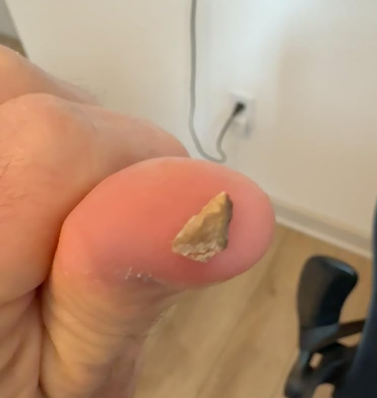 Dog Teeth Cleaning Kit,Dogs Tooth Brushing Kit with Light,3 Modes Doggie Toothbrush, Dog Plaque and Tartar Remover for Teeth,Low Noise Dog Teeth Cleaner,Pure White customer photo 1