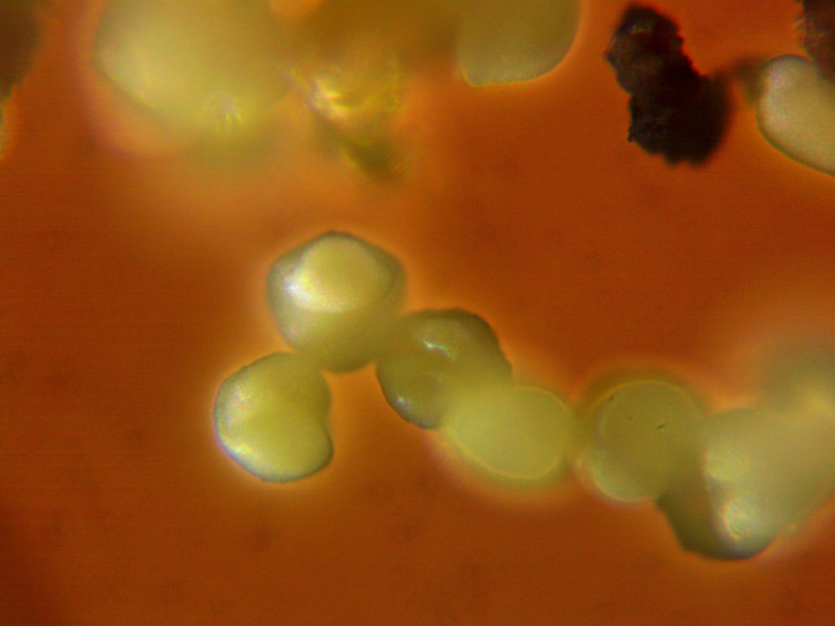 AmScope T490B Compound Trinocular Microscope, 40X-2000X Magnification, Halogen Light, Abbe Condenser, 2-Layer Mechanical Stage, High-Resolution Optics customer photo 1