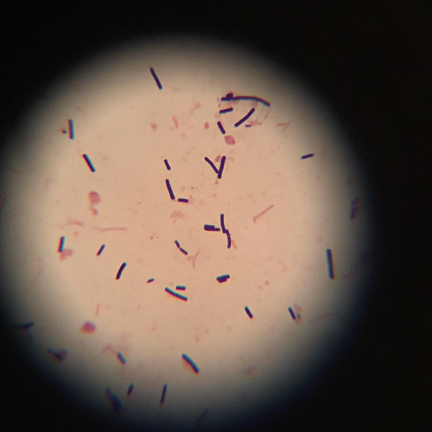 AmScope T490B Compound Trinocular Microscope, 40X-2000X Magnification, Halogen Light, Abbe Condenser, 2-Layer Mechanical Stage, High-Resolution Optics customer photo 2