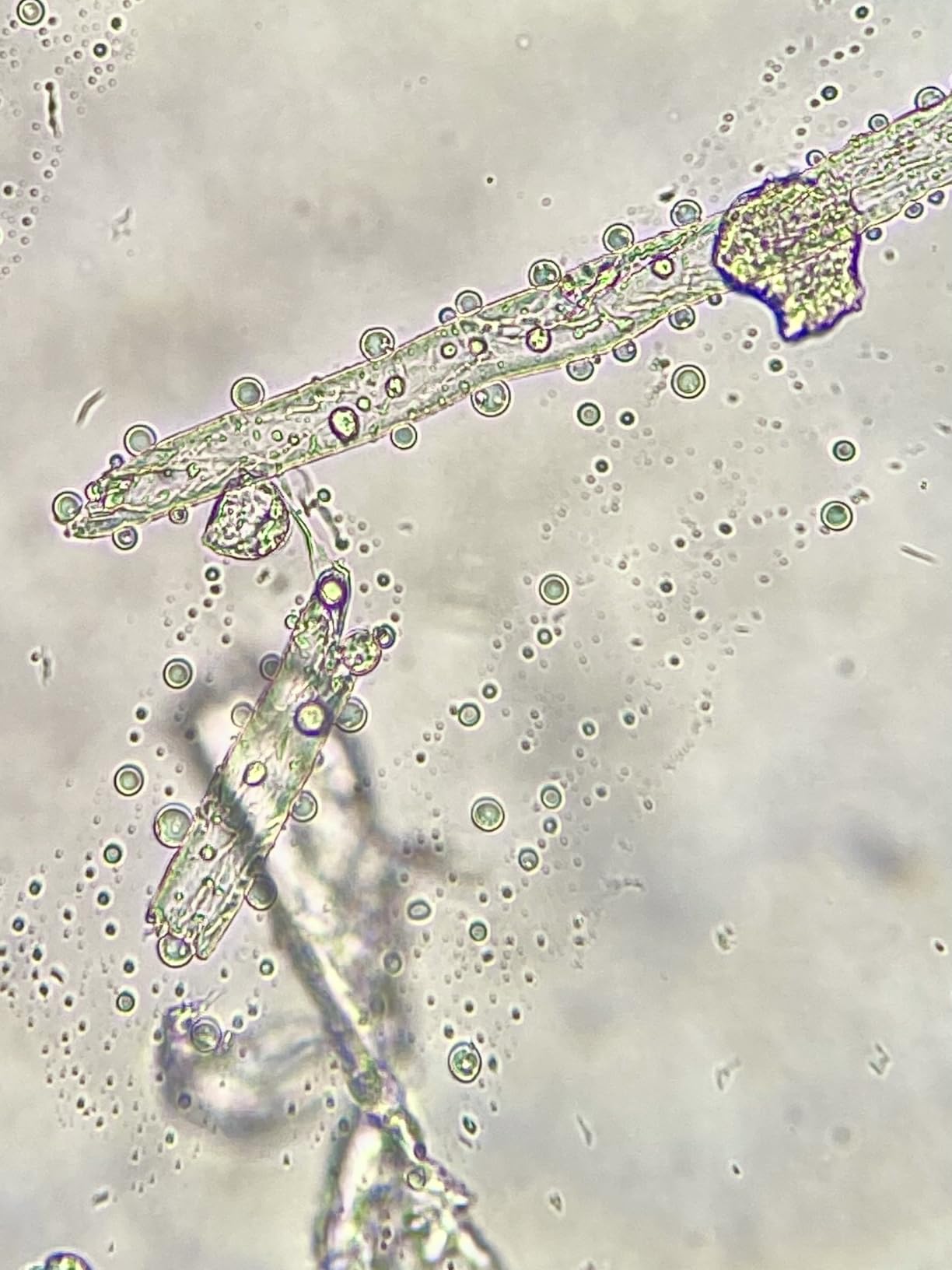 Swift SW380T 40X-2500X Magnification, Siedentopf Head, Research-Grade Trinocular Microscope Compound Lab with Wide-Field 10X/25X Eyepieces, Mechanical Stage, Ultra-Precise Focusing, Camera-Compatible customer photo 1