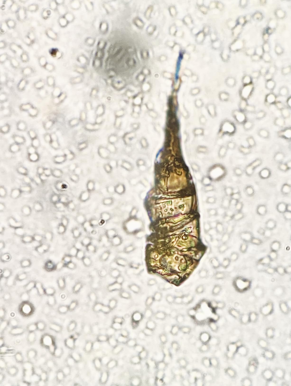 Swift SW380T 40X-2500X Magnification, Siedentopf Head, Research-Grade Trinocular Microscope Compound Lab with Wide-Field 10X/25X Eyepieces, Mechanical Stage, Ultra-Precise Focusing, Camera-Compatible customer photo 2