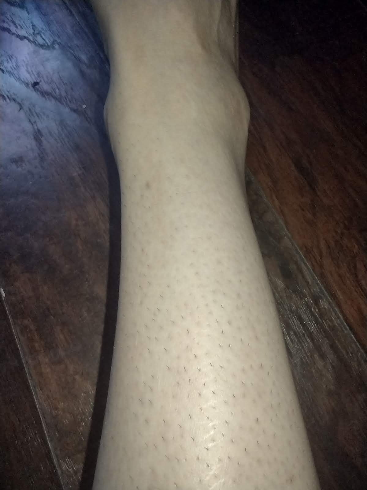 XSOUL At-Home IPL Hair Removal for Women and Men Permanent Hair Removal 999,999 Flashes Painless Hair Remover on Armpits Back Legs Arms Face Bikini Line, Corded customer photo 1