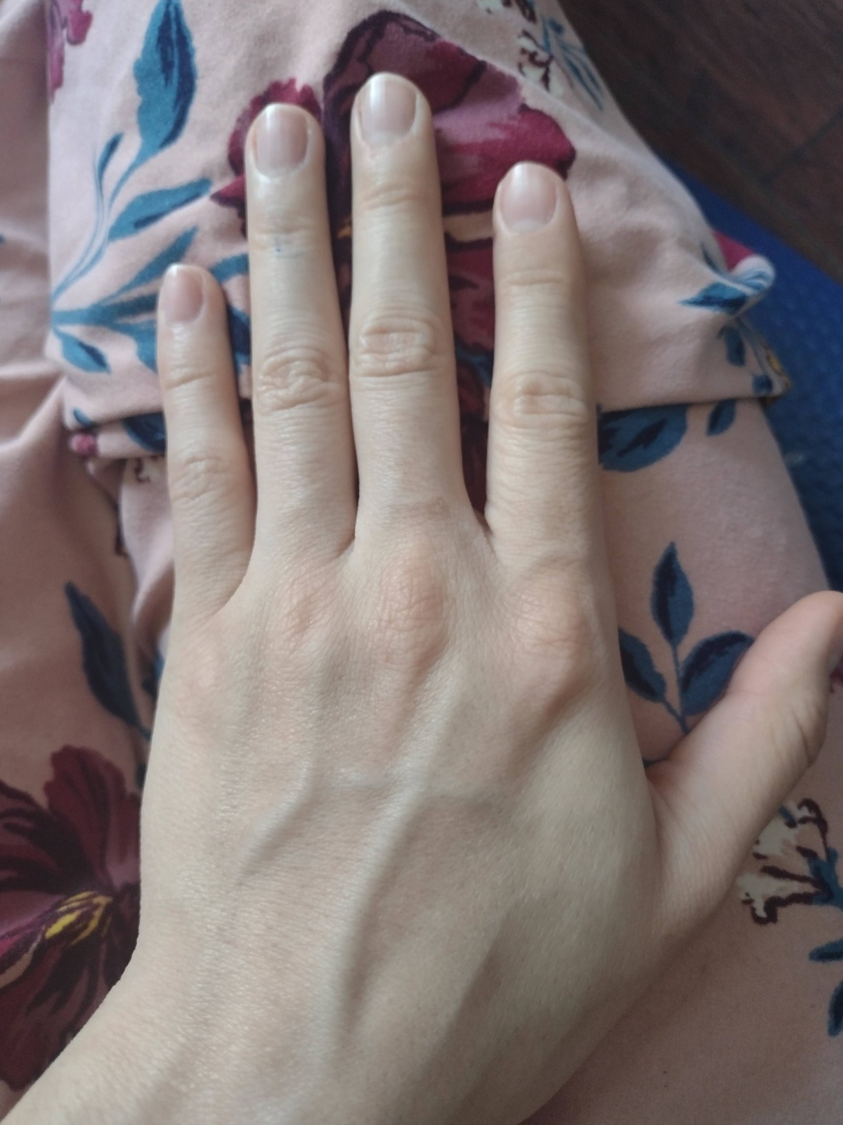 XSOUL At-Home IPL Hair Removal for Women and Men Permanent Hair Removal 999,999 Flashes Painless Hair Remover on Armpits Back Legs Arms Face Bikini Line, Corded customer photo 2