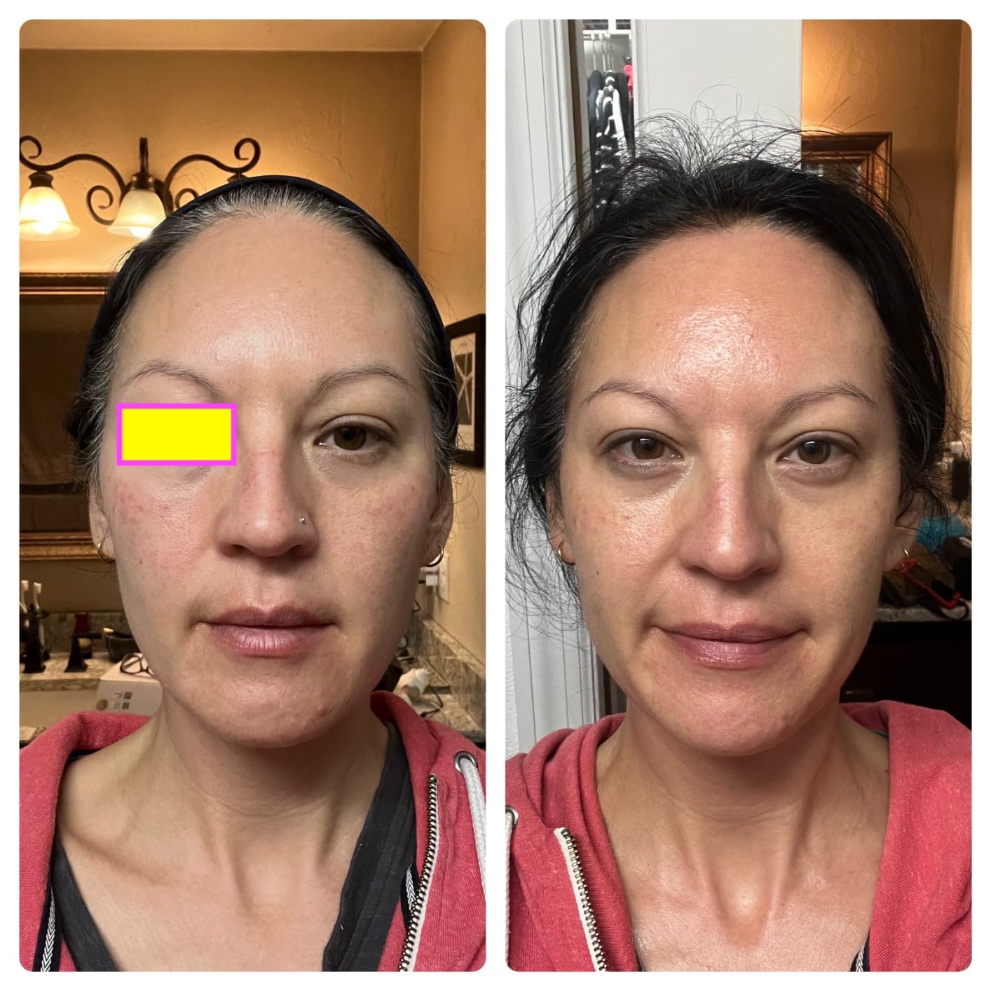 Therabody TheraFace PRO - Microcurrent Facial Device, 8-in-1 Compact Face Massager & Facial Sculpting Tool with Light Therapy for Skin Tightening, Anti Wrinkle, Anti Aging & Skin Care (White) customer photo 1