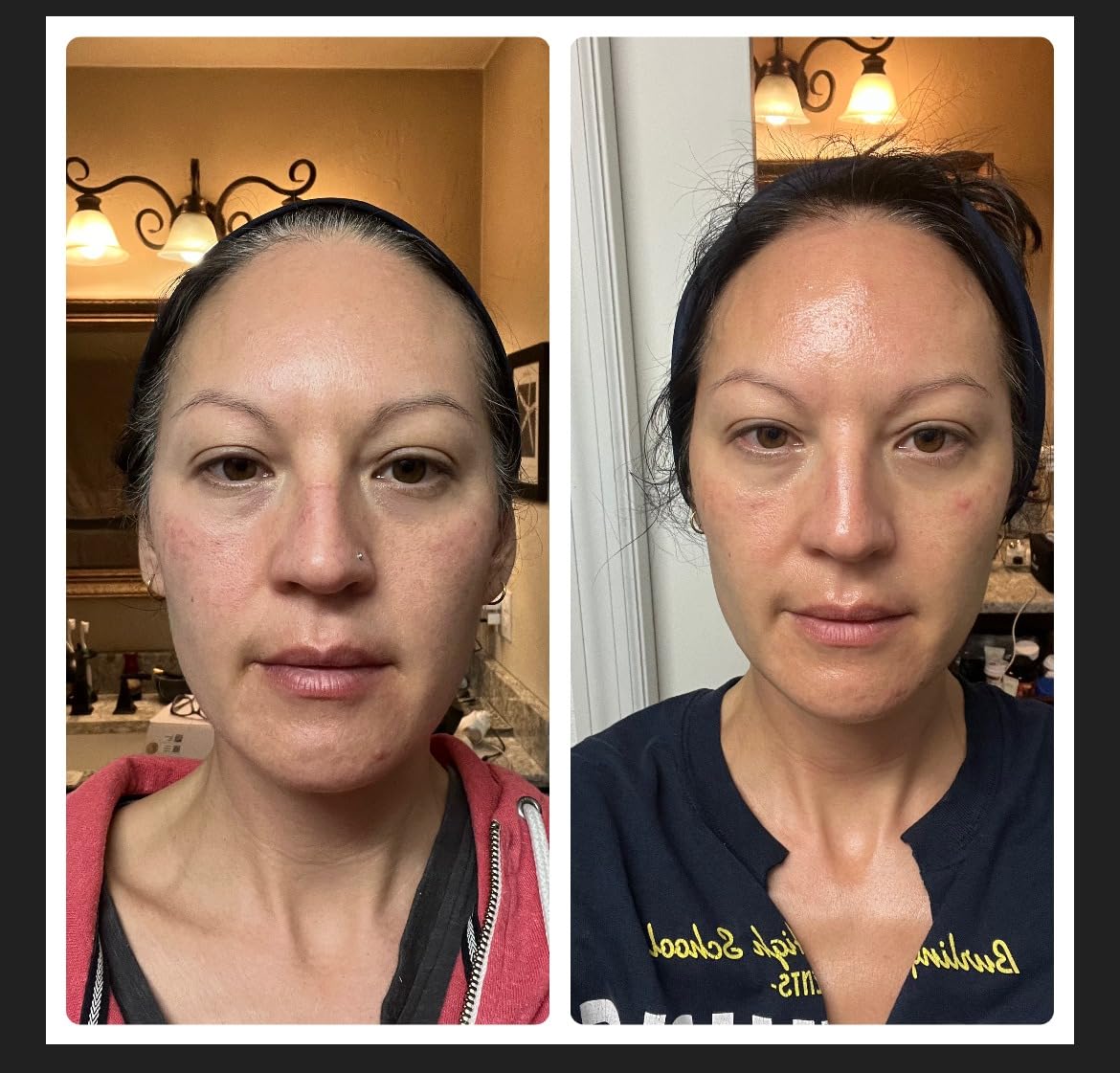 Therabody TheraFace PRO - Microcurrent Facial Device, 8-in-1 Compact Face Massager & Facial Sculpting Tool with Light Therapy for Skin Tightening, Anti Wrinkle, Anti Aging & Skin Care (White) customer photo 2