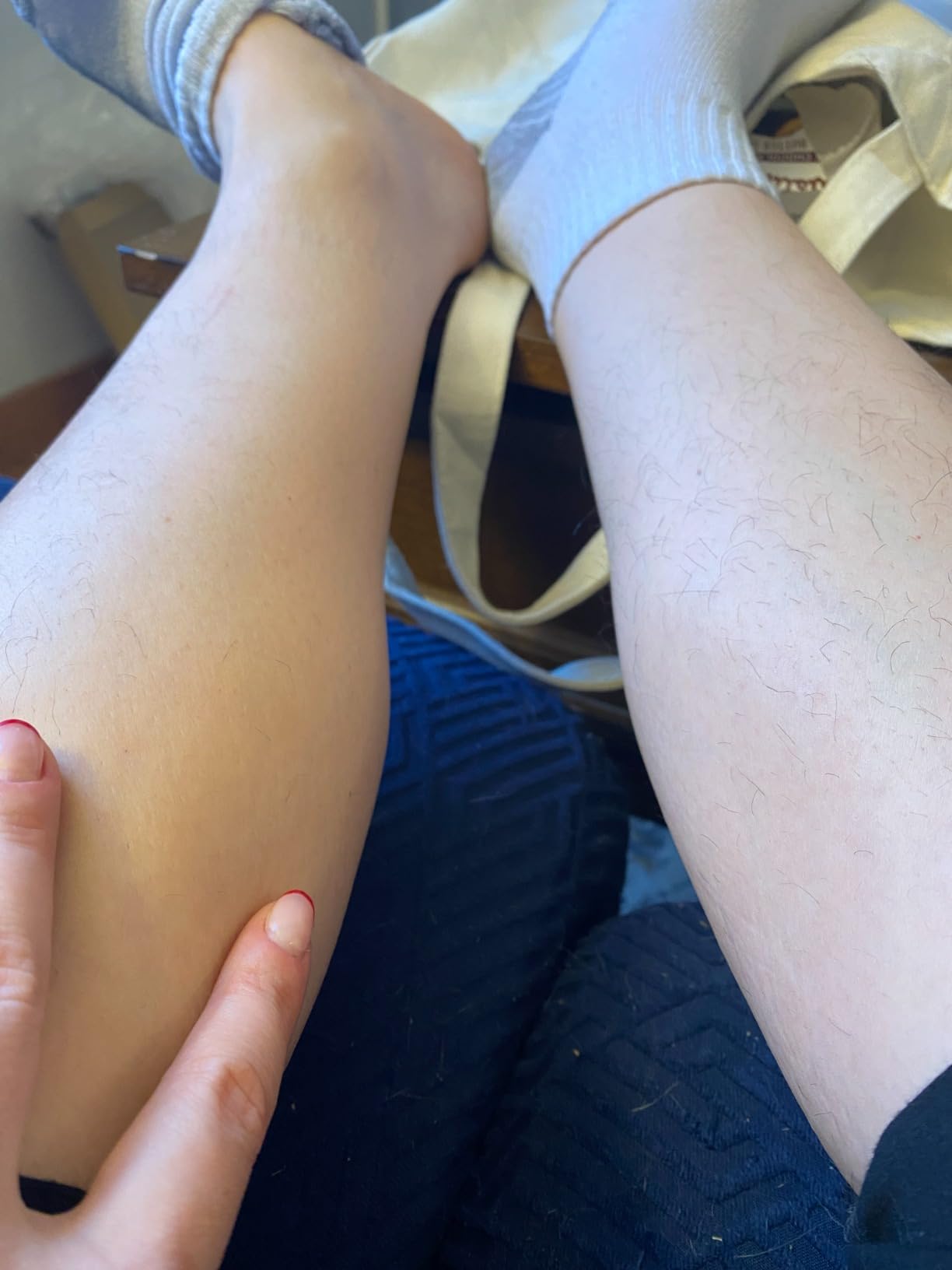 JOVS Laser Hair Removal, IPL Hair Removal for Women and Men, 37°F Painless Sapphire Ice-Cooling Tech, 6 Modes for Whole Body Hair Removal Device, 2 in 1 Skin Rejuvenation, 330° Rotation customer photo 1