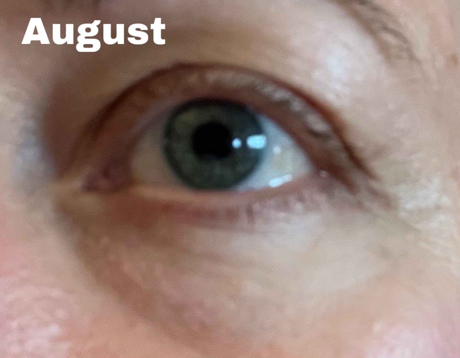 Dr Dennis Gross DRx SpectraLite Eyecare Max Pro customer photo 1