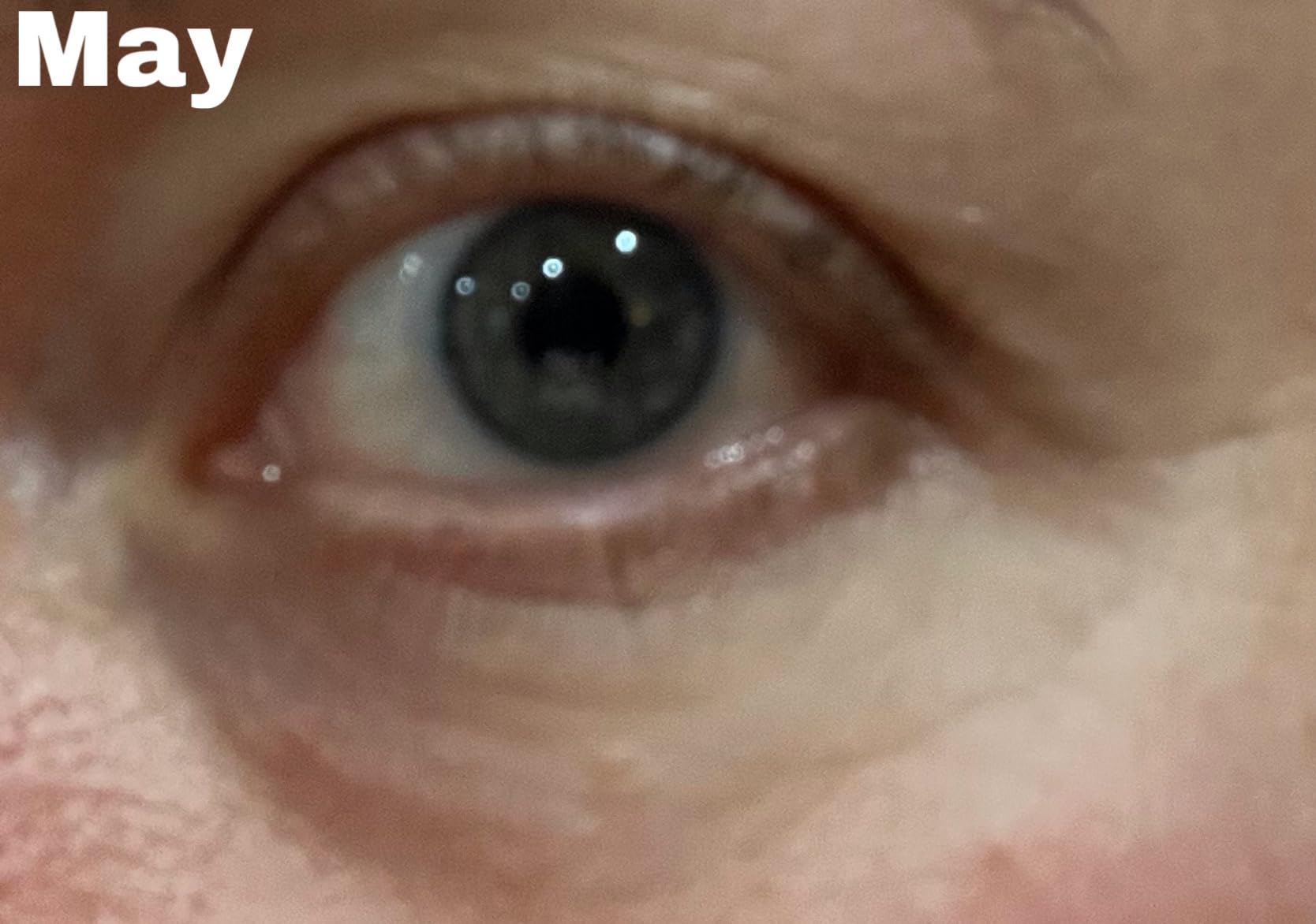 Dr Dennis Gross DRx SpectraLite Eyecare Max Pro customer photo 2