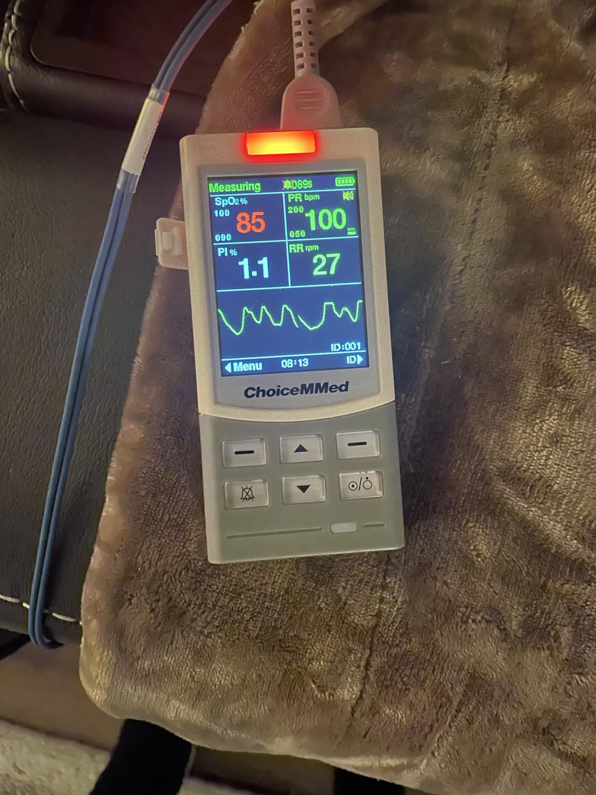 ChoiceMMed Handheld Pulse Oximeter for Vet Use - Heart Rate - Medical Monitoring for Dog, Cat, and Small Animals - Blood Oxygen Saturation Medical Monitoring Equipment customer photo 1