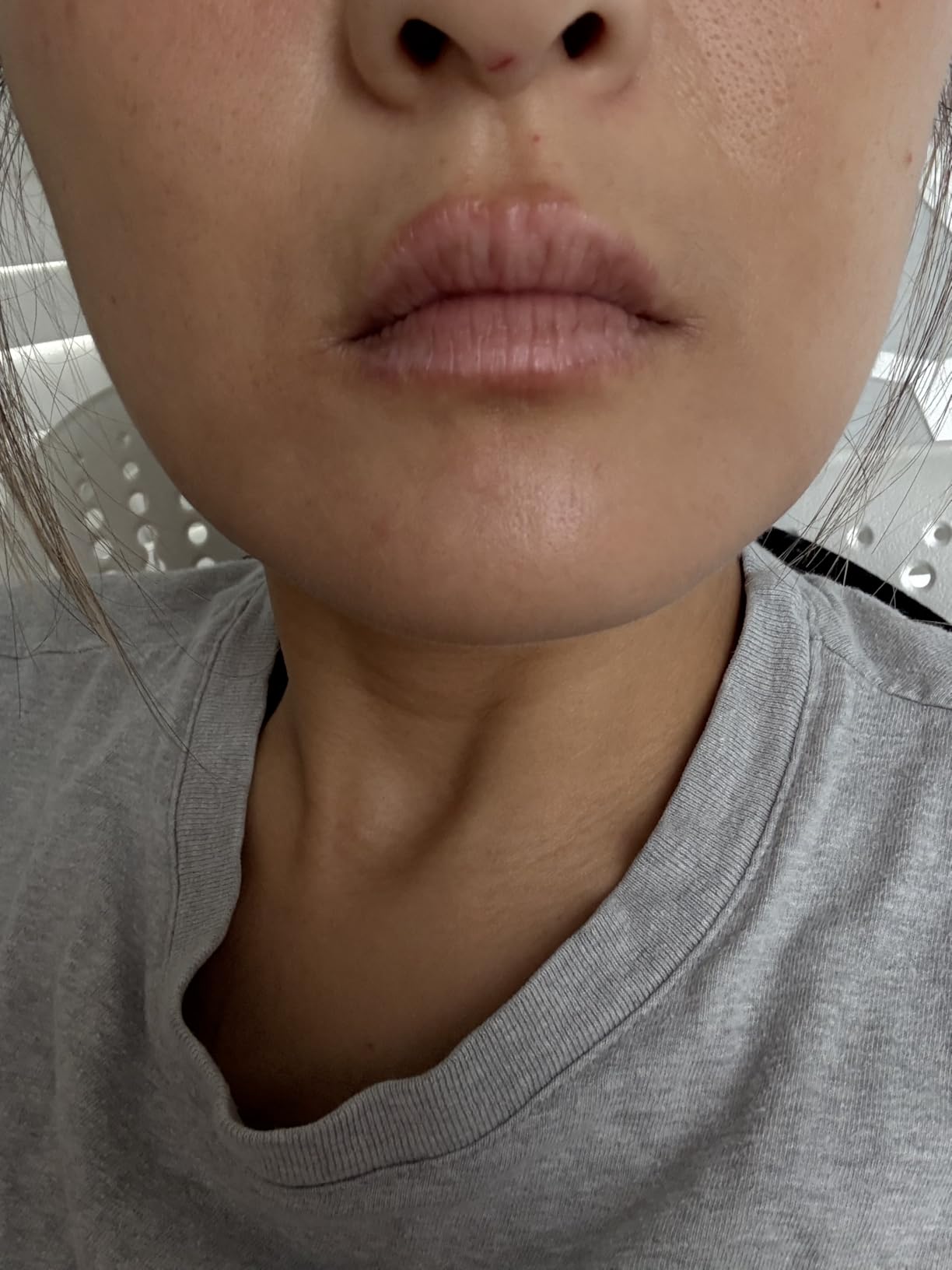 DRx SpectraLite LipWare Pro | Lip Treatment Device to Boost Collagen Smooth Fine Lines & Wrinkles and Firm Skin customer photo 1