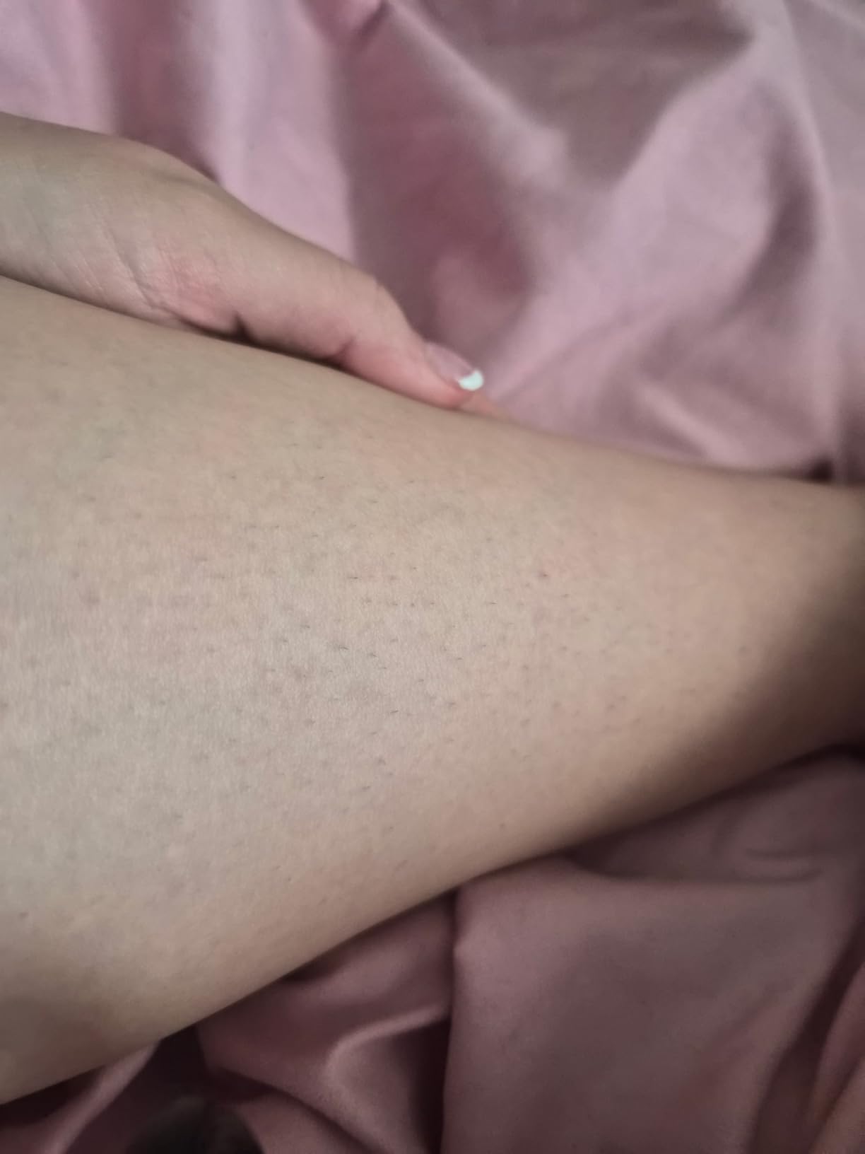 Laser Hair Removal, BoSidin IPL Hair Removal with Painless Ice-Cooling, 2-in-1 Face SR Rejuvenation, 6+1 Modes, 6 Levels Hair Removal for Women Permanent, Laser Hair Removal Kit with Shaver, Goggles customer photo 2