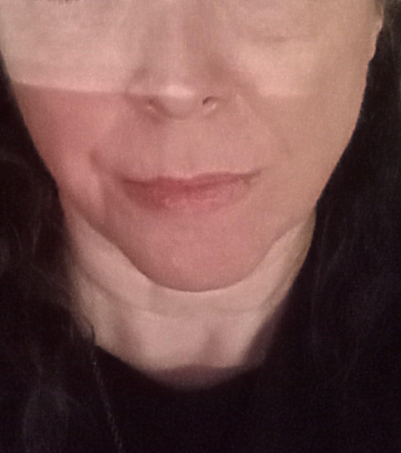 Radio Frequency Skin Tightening Device, Smart Electric Zinc Alloy Facial Beauty Machine with RF-Current Cold Heat for Jawline Lifting, Cheek Firm, Wrinkle Reduction, Depuff, Increase Absorption customer photo 1